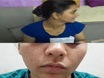SEMINAR at TATA MEMORIAL HOSPITAL